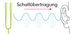 Zeichnung: Schallübertragung